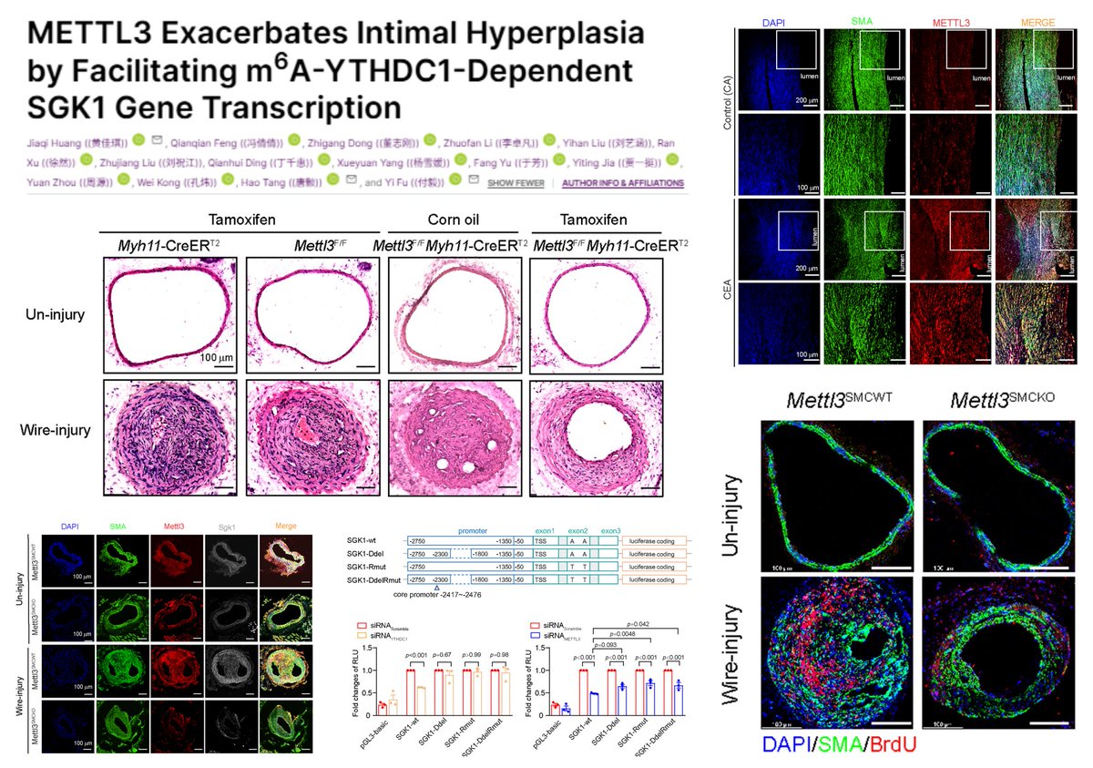 HaoYin20's tweet image. #SmoothMuscleCell m6A Epitranscriptomics

METTL3 &amp;amp; WTAP (m6A writer) ⬆️in👤carotid arterial intima

METTL3-YTHDC1 (m6A reader) ⏫SGK1 mRNA synthesis (but not stability)

135 candidate METTL3 target genes by RNAseq + MeRIPseq in rat SMC

SMC Mettl3 KO🐭➡️
⏬injured carotid…