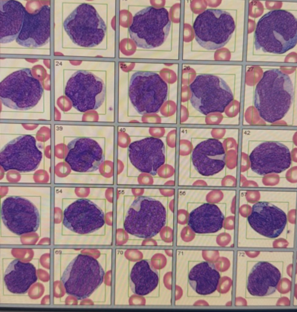 AskClinicalLab tweet picture