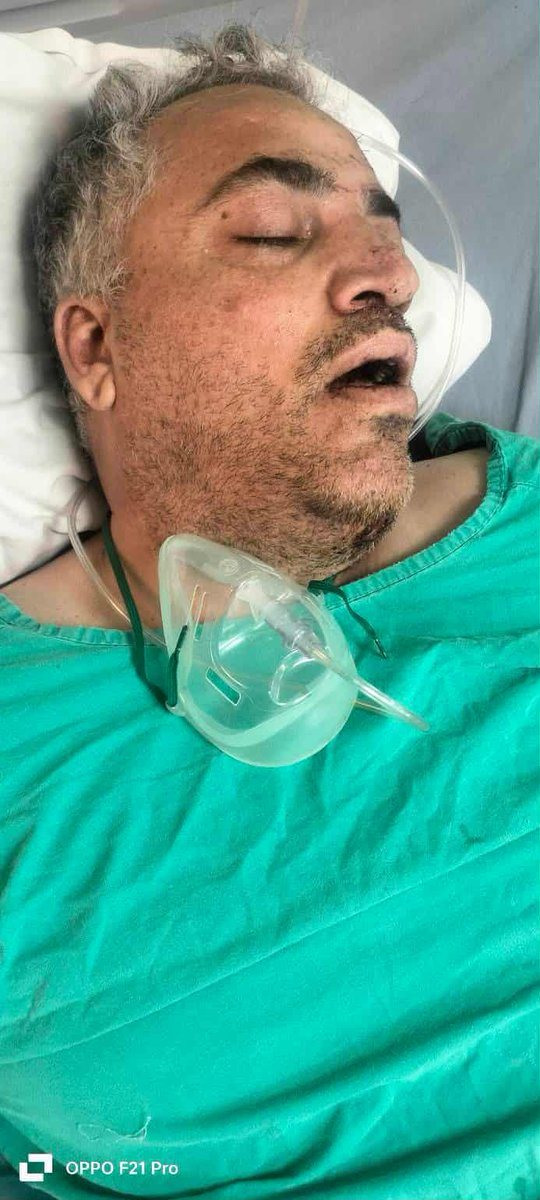 AmirSalar_Wazir's tweet image. اسلام اباد

موٹر وے پر بورہان انٹرچینج کے قریب پیش آنے والے افسوسناک حادثے کے زخمیوں کی عیادت کے لیے، ہمارے محترم ایم این اے جناب زبیر خان وزیر نے ہولی فیملی ہسپتال کا دورہ کیا۔ دورے کے دوران ایک لاوارث بندہ ملا جو کوئی نہیں جانتا 

🩺 ہسپتال انتظامیہ کے مطابق ایک زخمی شخص بھی