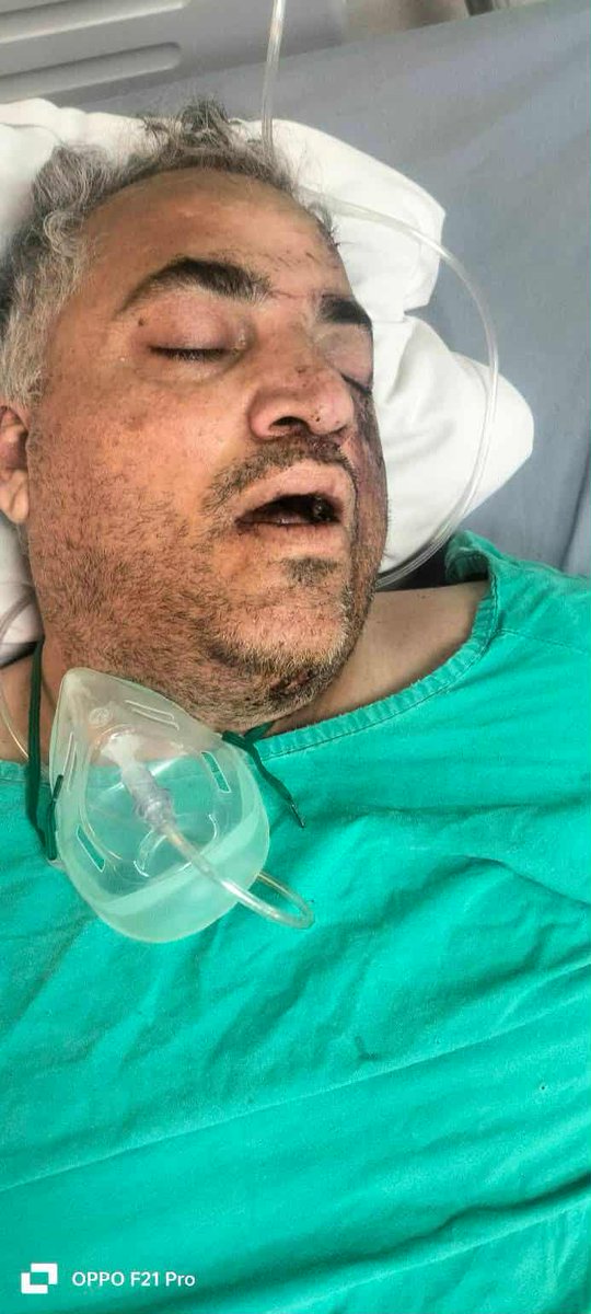 AmirSalar_Wazir's tweet image. اسلام اباد

موٹر وے پر بورہان انٹرچینج کے قریب پیش آنے والے افسوسناک حادثے کے زخمیوں کی عیادت کے لیے، ہمارے محترم ایم این اے جناب زبیر خان وزیر نے ہولی فیملی ہسپتال کا دورہ کیا۔ دورے کے دوران ایک لاوارث بندہ ملا جو کوئی نہیں جانتا 

🩺 ہسپتال انتظامیہ کے مطابق ایک زخمی شخص بھی