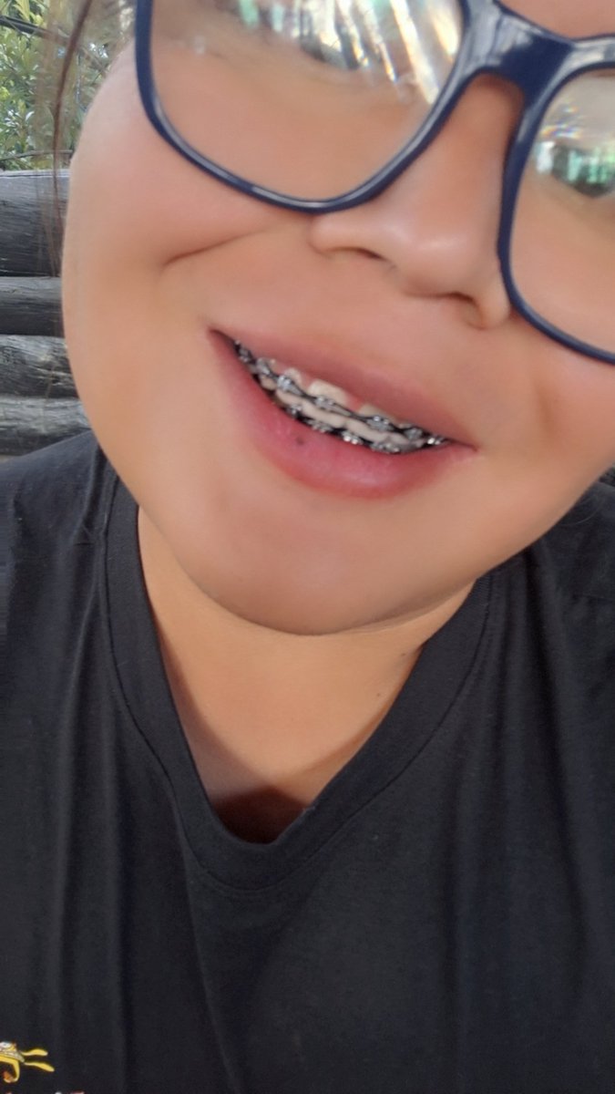 AndryVD196's tweet photo. Con el encanto de Huehue y una sonrisa que no se olvida 😉 https://t.co/tvmGYJPBjp