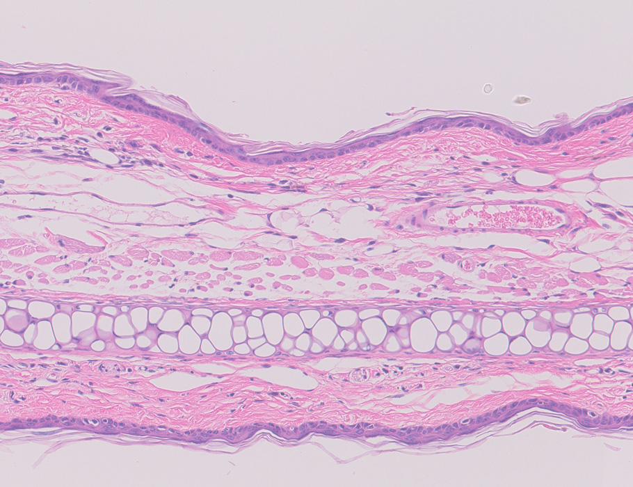 ScienceTM's tweet image. Using a multi-step stimulation protocol, a team shows they can convert self-reacting, pathological CD4 T cells into stable antigen-specific regulatory T cells to suppress autoimmunity and treat #pemphigus vulgaris in mice. @KeioGlobal scim.ag/43M0twn