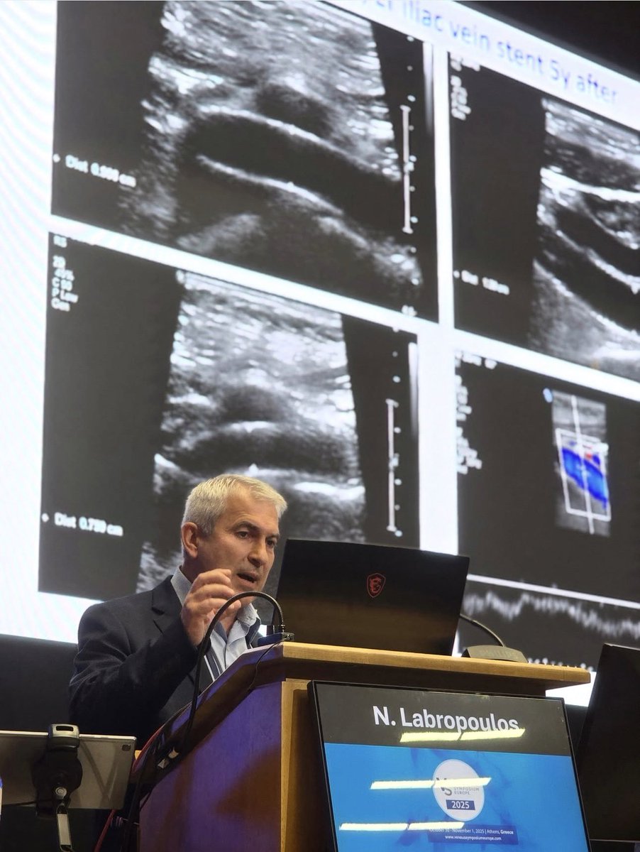 Stony Brook Vascular tweet media