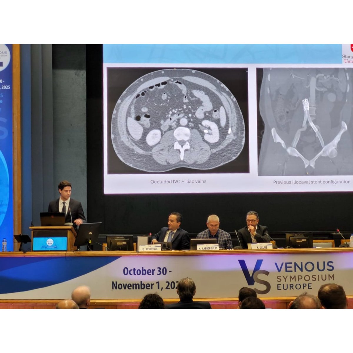 Stony Brook Vascular tweet media