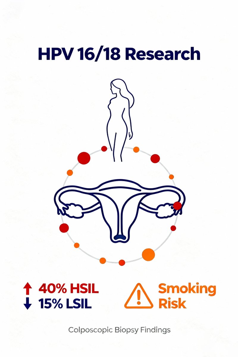 🚨40% of HPV 16/18+ women with normal/ASCUS smears hide HSIL on biopsy! 🔬 #HPV1618 #CervicalScreening
📚Read more:ejgo.net/articles/10.22…