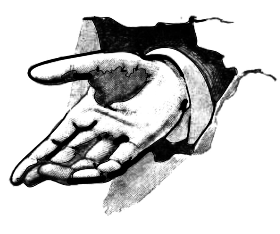 Are you prone to slivers? Then sign up for the City of Toronto's annual sliver workshop, where you'll learn about the underlying properties of wood, experimental methods of sliver extraction (e.g. extreme jostling; hand immersion in liquid nitrogen), and how to endure the shame.