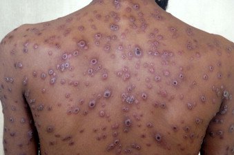 Dr. AK 🇮🇳 tweet media