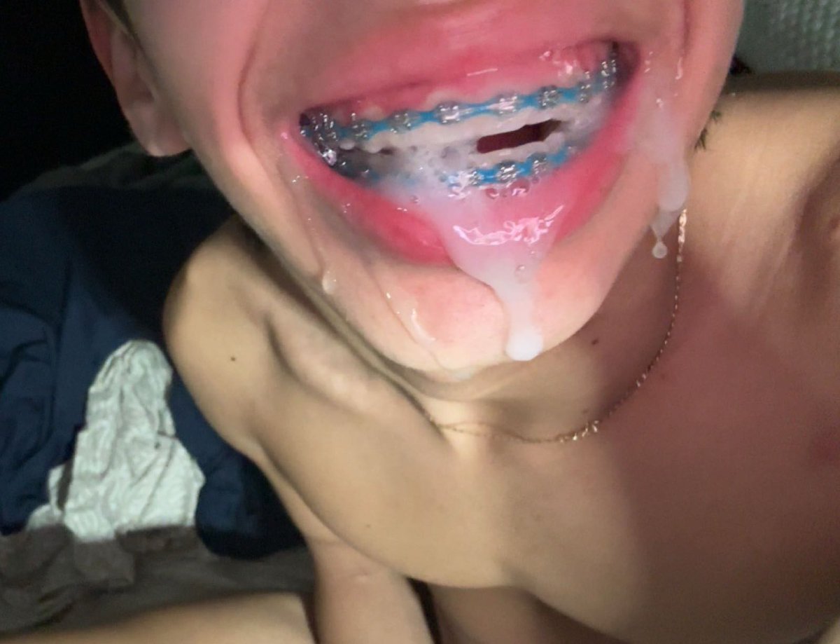 stop cvuming on my braces bro😵‍💫 #goon #gay #bate  (the video is even better$)
