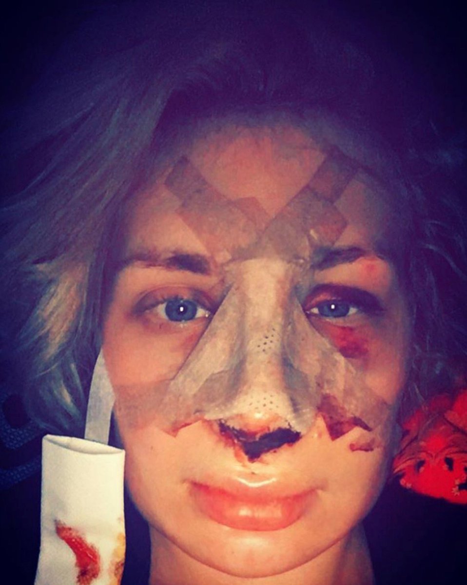 Laura Loomer is in Israel getting another face transplant.

What’s the point of surgery when the problem is the inside?