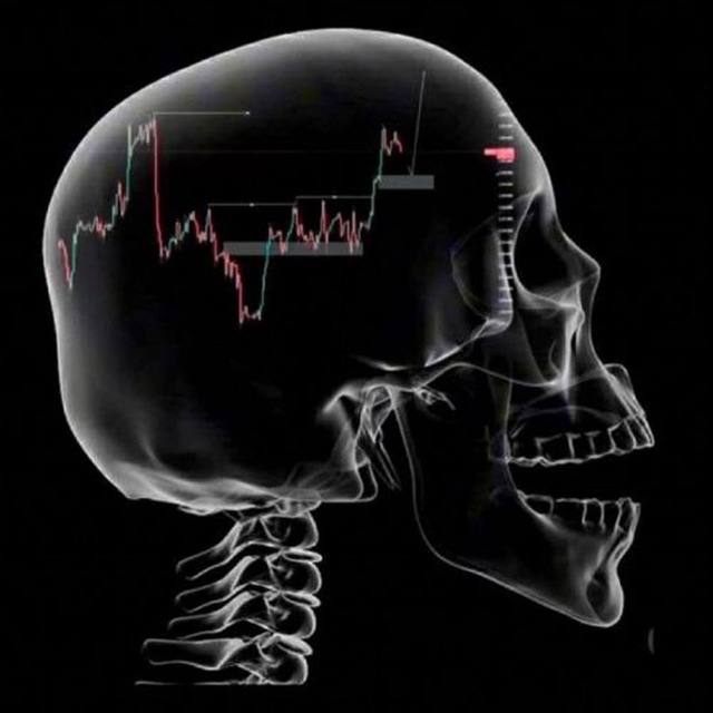 themetashark's tweet image. 🚀 Meet Smart Bot — Your 24/7 Crypto Assassin 🤖💰

No signals. No emotions. No missed plays.
Smart Bot hunts profit automatically — scanning the markets, detecting high-probability setups, and executing futures trades with precision timing.
🔥 Fully automated
📈 Profitable…