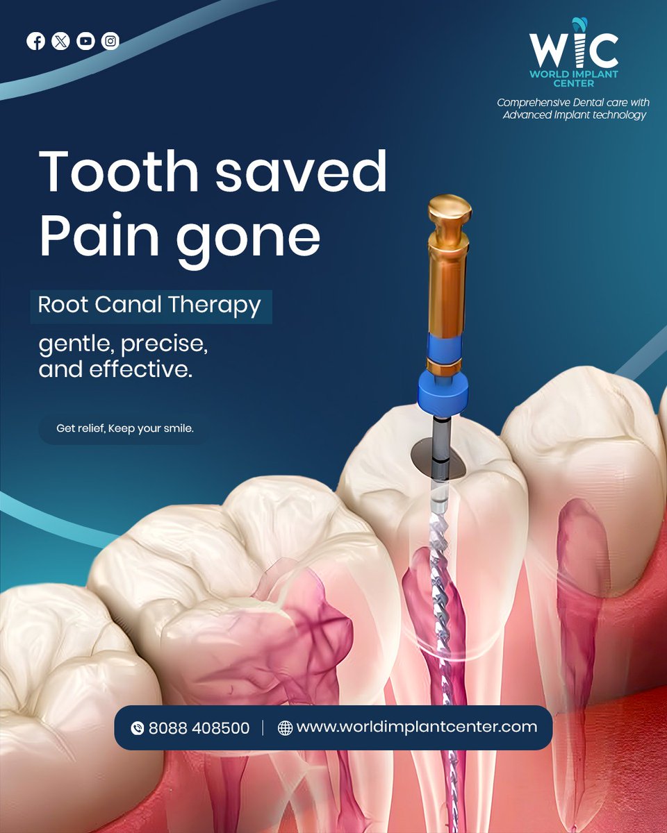 WImplantCare's tweet image. 😁 Brighten Your Smile, Transform Your Confidence
Experience painless implants &amp;amp; gentle root canal care at WIC - World Implant Center 💎
📍 Bangalore | 📞 9980808500
🌐 worldimplantcenter.com

#WorldImplantCenter #HealthySmile #ImplantExperts #PainlessDentistry