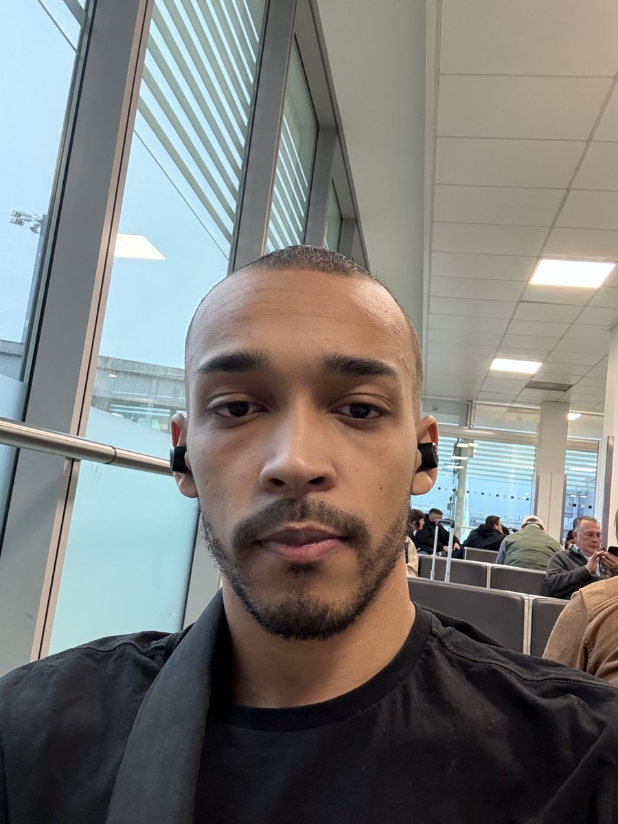 For every 5 likes I will increase Richie's forehead.