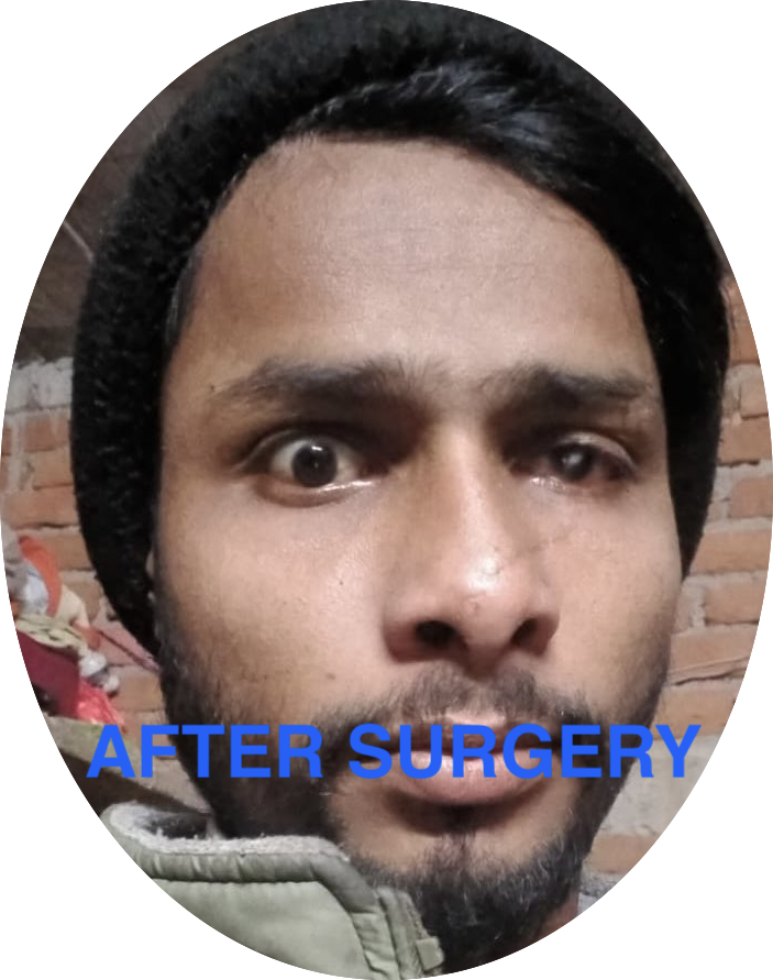 ANIRUDH_UP's tweet photo. #Trauma #Accident #plasticsurgery Pre and post surgeries photos......
contact no. 9901787948 https://t.co/QNEVmwi7ZK