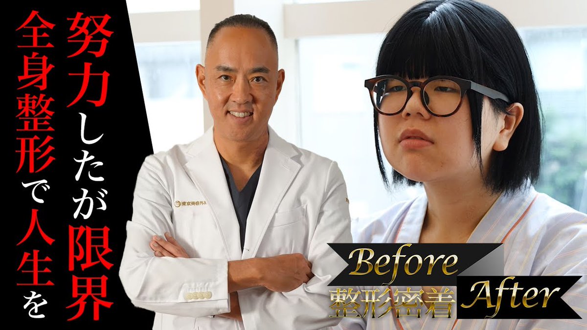 【整形密着BeforeAfter】美しくなるために努力したが自分では限界！全身プロデュース！重たい目、顔の余白を減らして卵型の顔に【ドクターA（東京美容外科）】
youtu.be/QQA08hd1Enw