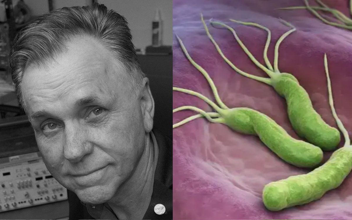 Dr. Barry J. Marshall was convinced that H. pylori bacteria causes stomach ulcers, but no one believed him. Since it was illegal to test his theory on humans, he drank the bacteria himself, developed ulcers, treated them with antibiotics, and went on to win a Nobel Prize.