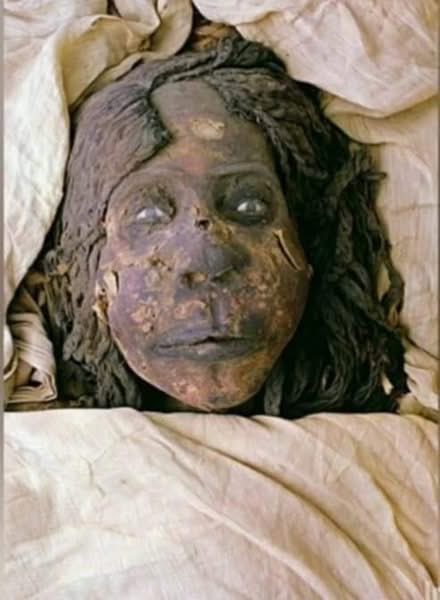 drmagedsamy's tweet photo. كان عند المصري القديم عمليات تجميل ؟!!

كان بيتحط فاونديشن (كريم أساس) زمان ايام المصري القديم؟!!

كان فيه شعر وعيون صناعية زمان ايام المصري القديم؟!!

تخيل إن أحدث صيحات التجميل اللي بنشوفها دلوقتي زي نفخ الخدود وتركيب الشعر أصلها يرجع لملكة مصرية قديمة من آلاف السنين!
الملكة 'نجمت'
إيه سر شكل المومياء الغريب ده وازاي الملكة 'نجمت' قدرت تكون أيقونة عمليات تجميل سبقت عصرها بكتير؟

سر شكلها الغريب
(عمليات التجميل القديمة)؟

• شكل المومياء خصوصا منطقة الخدود المنتفخة هو الحقيقة أصل عمليات التجميل اللي بتتعمل اليومين دول بالظبط.
• الملكة نجمت كانت كبيرة في السن والجلد عندها كان مترهل وهي كانت عايزة تبعث على سن الشباب في الحياة التانية.
• المصري القديم عمل لها خدعة حلوة فتح الجلد وحط تحته "باكيتات" أو حشوات كتير عشان يعمل النفخان ده وترجع شباب وده اللي خلى شكل خدودها منتفخ.
• الالتئام بتاع الجرح كان بيتعمل بـ شمع العسل اللي بيرجع الجلد زي الأول.
• لما نقلوا المومياء لمتحف الحضارة، لاقوا إن المومياء نشفت قوي والحشوات دي فرقعت أو بانت وده اللي بيأكد حكاية الحشوات دي.

-كان بيتحط فاونديشن (كريم أساس) زمان ايام المصري القديم؟!!

• المحنطين فكروا إنهم يعالجوا لون وشها اللي اسودّ بعد التحنيط فراحوا حاطين لها فاونديشن لونه أصفر عشان يفتح الوش شوية.
• بس المادة الصفراء دي تفاعلت مع مواد التحنيط وعملت بقع وألوان مختلفة (صفرا وحمرا وسودا) على الوش.

-كان فيه شعر وعيون صناعية زمان ايام المصري القديم؟!!

• الضفاير اللي على رأسها دي مش شعرها الطبيعي دي خصلات مركبة عشان شعرها يبان أكتر نضارة وكثافة وشباب.
• العين اللي موجودة دي مش عينها الحقيقية لأن العين الأصلية بتسيح وبتدوب.
المصري القديم ركب لها عين صناعية عشان تفضل العين مفتوحة.

مين هي الملكة نجمت؟
• هي بنت الملك رمسيس الـ 11 ومرات الملك حريحور (أو سمندس).
• المومياء بتاعتها دي معجزة وفيها أسرار كتير وهي اللي كان ليها دور إن الحكم يتنقل من الأسرة الـ 20 للأسرة الـ 21.

الملكة نجمت هي أيقونة عمليات التجميل اللي بتحصل دلوقتي سواء من تركيب شعر أو حشوات نفخ للخدود أو حتى استخدام الفاونديشن.