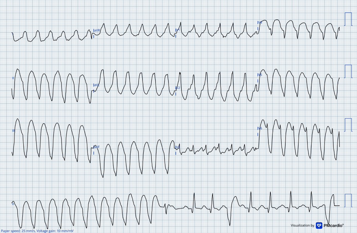 Dr. Andreas Roeschl tweet media
