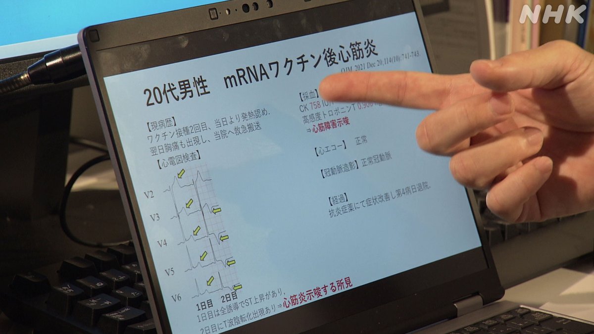 nhk_sciencezero's tweet image. 📺再放送は あす 午前11時〜[Eテレ]
#サイエンスZERO
◤副反応をなくせ！“安全なmRNAワクチン”を◢

4年前はじめて実用化されたmRNAワクチン
しかし接種後の副反応に悩み続ける人も…
次世代のmRNAワクチンを生み出す最新研究に迫る

／
見逃し配信は
9(日) 夜11:59 まで
＼
web.nhk/tv/pl/schedule…