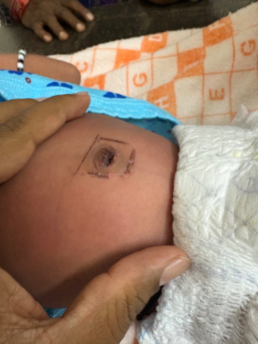 2k5naresh's tweet photo. Branding, no use, don’t do this

#MedTwitter #PediatricTeam2026 #Children’s Doctor https://t.co/DNINf5ZZSs