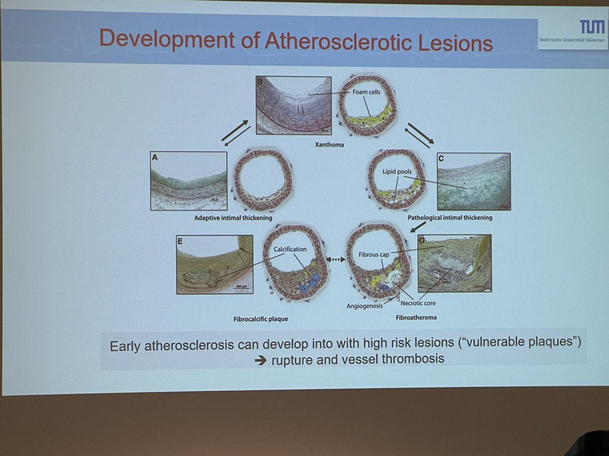 stefan_harb's tweet photo. Inaugural #DCBClub meeting 
just has commenced in an 
antiquated lecture hall
of Charite Berlin!
A new family of interventional cardiologist
is evolving …
Bruno Scheller Franz Kleber Ton Waksman
Antonio Colombo Simon Eccleshall
Peter O’Kane Mila Kovacevic Helen Routledge https://t.co/ULnTbV93r6