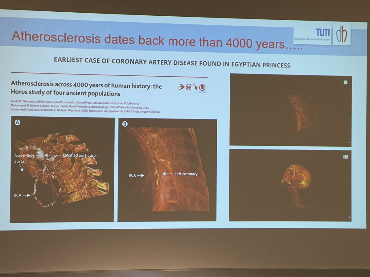 Inaugural #DCBClub meeting 
just has commenced in an 
antiquated lecture hall
of Charite Berlin!
A new family of interventional cardiologist
is evolving …
Bruno Scheller Franz Kleber Ton Waksman
Antonio Colombo Simon Eccleshall
Peter O’Kane Mila Kovacevic Helen Routledge