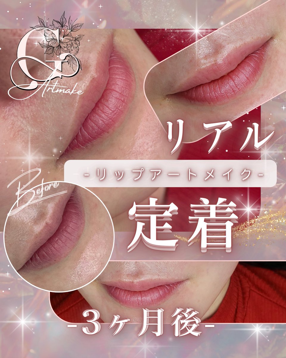 アートメイク横浜・東京 |げん(GEN)ルメラ公認メラティスト