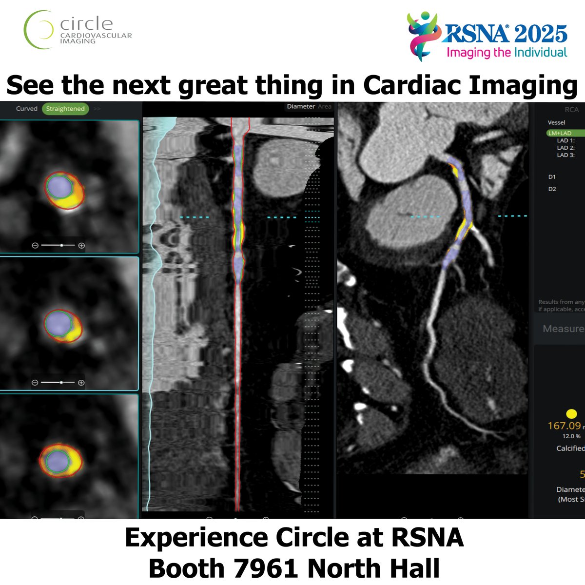 circlecvi's tweet photo. Thousands of clinicians worldwide rely on cvi42 for advanced cardiovascular visualization and quantification.

Discover why leading imaging centers trust Circle for reliability, reproducibility, and precision.

See it in action at #RSNA2025 – Booth 7961.  
https://t.co/RS6xxPo1IY https://t.co/zpWgSk2tYN