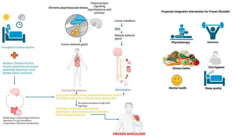 Omid_HopeUni's tweet image. “Frozen Shoulder”

Overview of the multifactorial pathophysiology and proposed integrative treatment strategies👇🏼

#shoulder #health
pmc.ncbi.nlm.nih.gov/articles/PMC11…