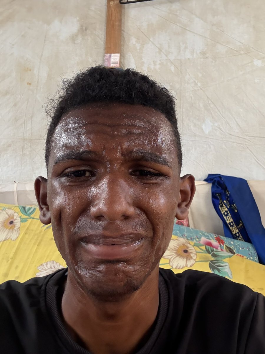 Ismail_obaid1's tweet photo. I'm really hungry, human, do you really care, okay, please leave a point or 5 dollars, please🙏

Sudan🇸🇩

https://t.co/ehgfejstdx https://t.co/9n41q52Dac