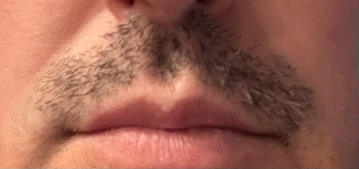 Day 7 of #NoShaveNovember