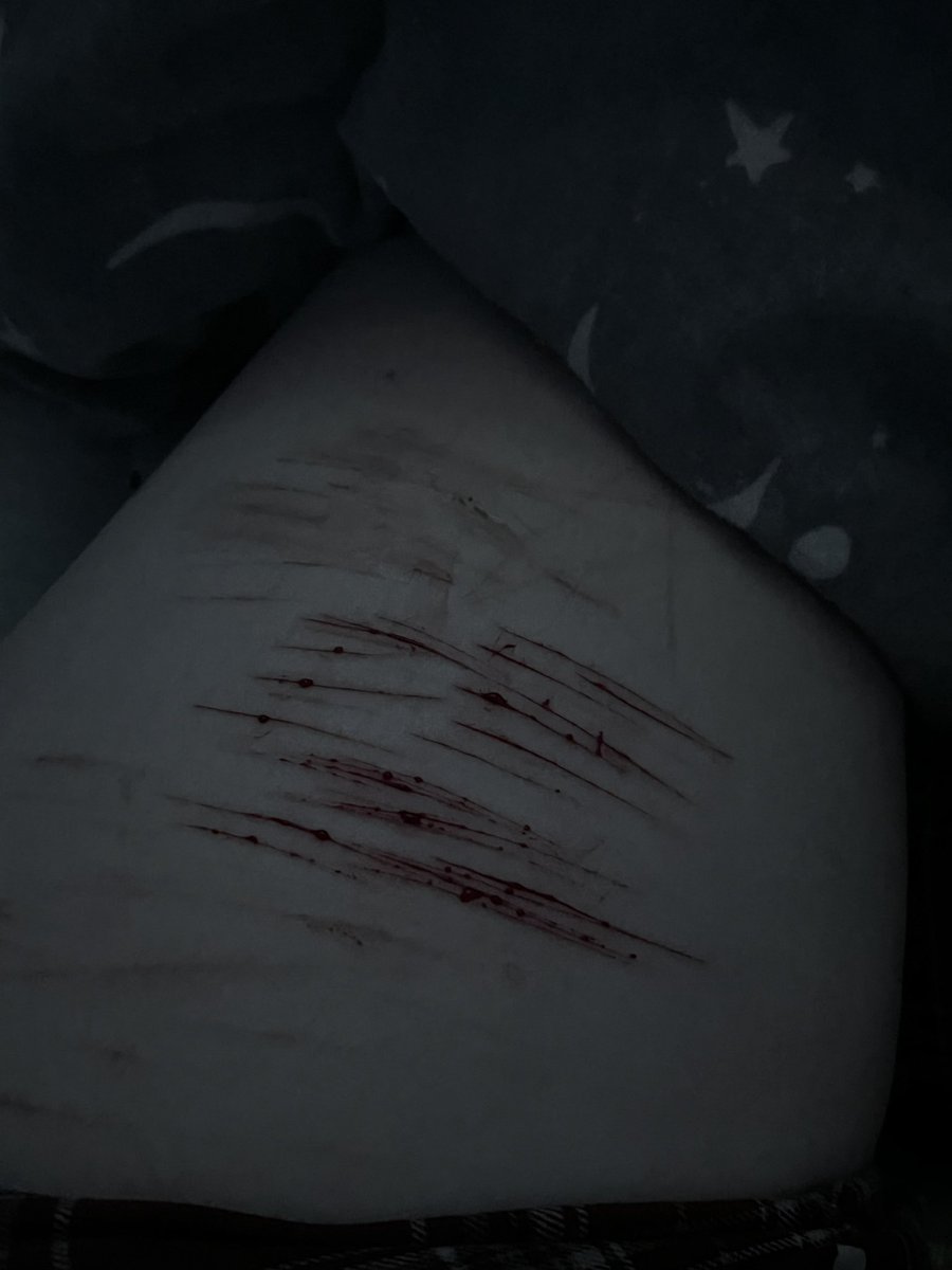 Pipxrrrrr's tweet photo. #shtwt #bloodtwt #paintwt https://t.co/fwbZMT4Rco