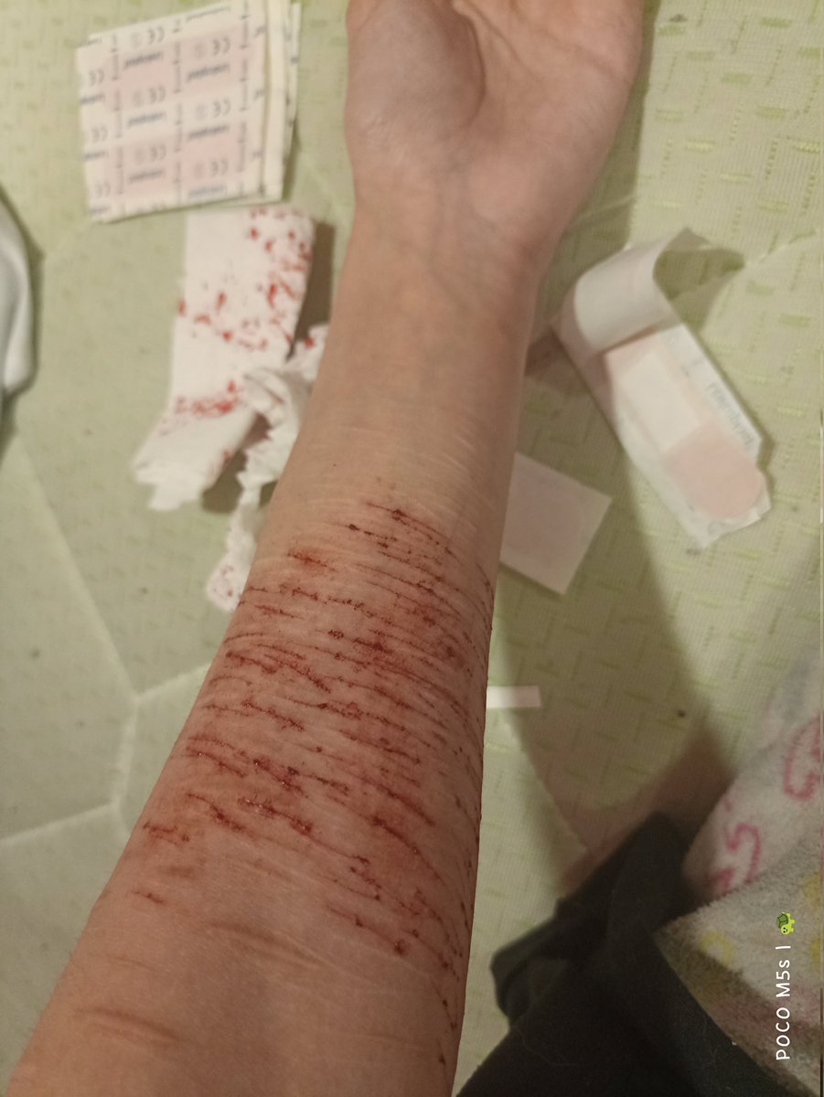 saikoru_me's tweet photo. No hace falta usar los curitas pero se siente chistoso https://t.co/CHfXiT2uA3