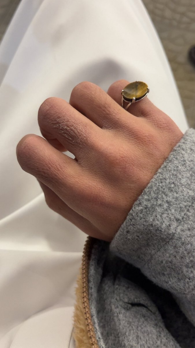 احيان الشيء اللي تحبه يكون هو سبب جرحك ، 
الاصبعين هذي انحرقن بسبب شاهي ، جيت ابي اصب لي كاسه وكنت متحمس ومشتهي لي كاسه ف بالغت بحماسي واندفاعي وصبيت اكثر من اللازم وصار على يدي، 
اصبح الشاهي مؤذي بعد ماكان مسالم"
وهذا اللي يخلينا مانندفع في كُل مانحب ..