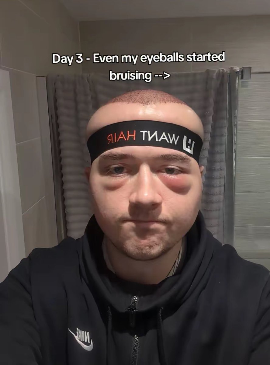 Estoy llorando, parece los jugadores que se crean los chavales en el clubes pro