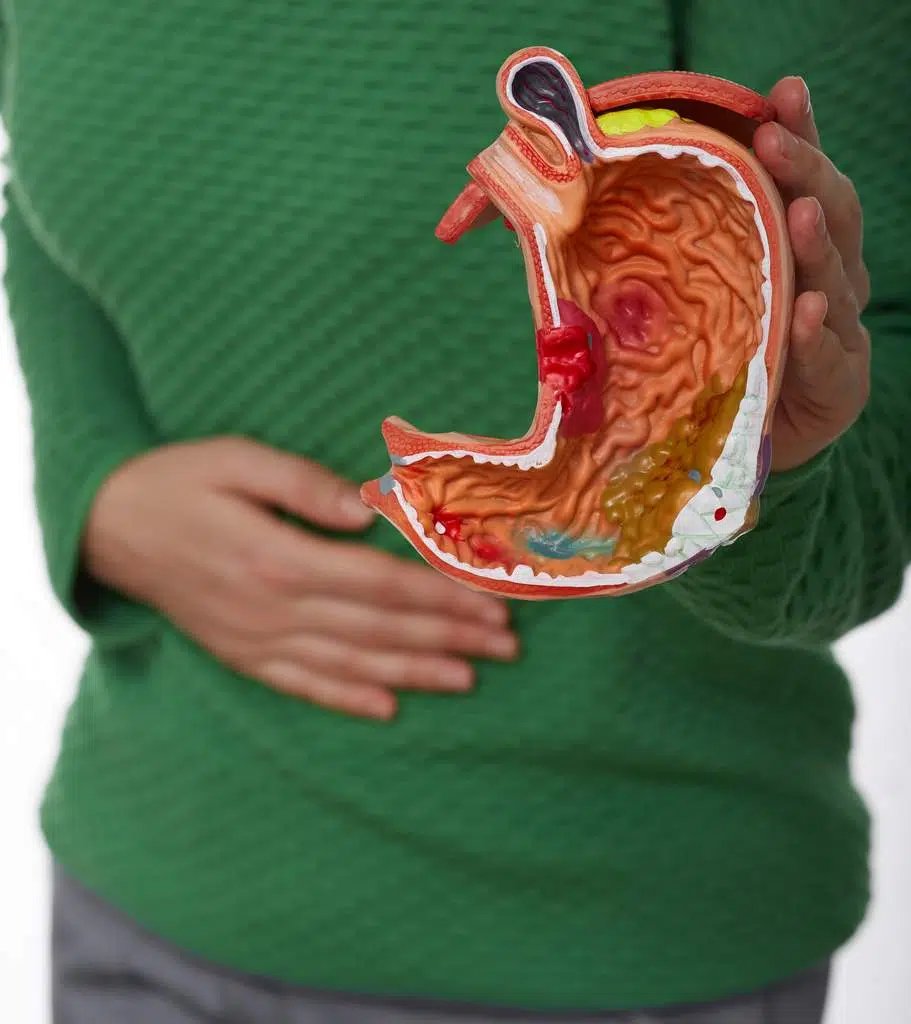 yes_estaloca's tweet photo. El cáncer gástrico continúa siendo una de las principales causas de mortalidad relacionada con el cáncer en varias regiones y presenta un desafío importante para el sistema de salud.
https://t.co/UjvNfvFWzH https://t.co/6faKmXpUC7