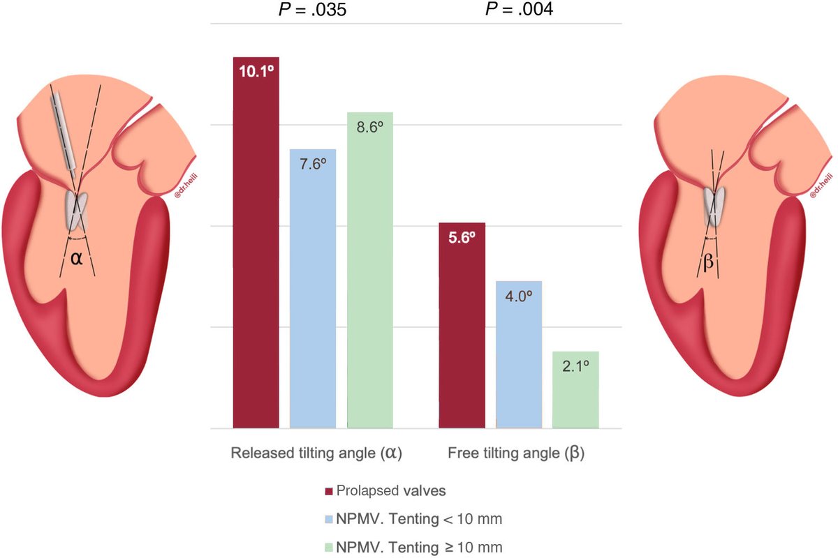 Predictability and device tilting in edge-to-edge mitral valve repair #REC @chpedroli <a href="/AsmaratsL/">Lluis Asmarats</a> <a href="/amassovr/">Albert Massó van Roessel</a> <a href="/icsMillan/">Xavier Millán</a> <a href="/StructuralBCN/">Dabit Arzamendi</a>. revespcardiol.org/en-predictabil…