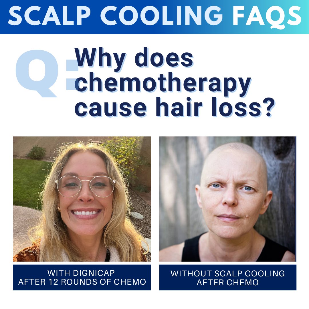 DigniCap's tweet image. Chemo-induced hair loss is no longer inevitable. Along with killing #cancer cells, #chemo agents can damage hair follicles. #Scalpcooling with #DigniCap can help protect hair follicles, minimizing hair loss. More info at dignicap.com/faq

#breastcancer #coldcap