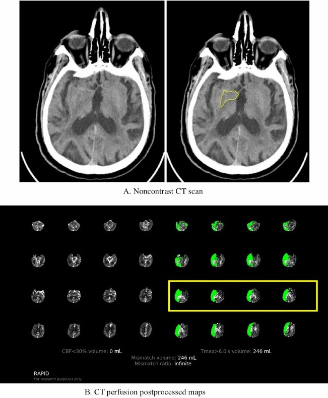 Journal of Neuroimaging tweet media