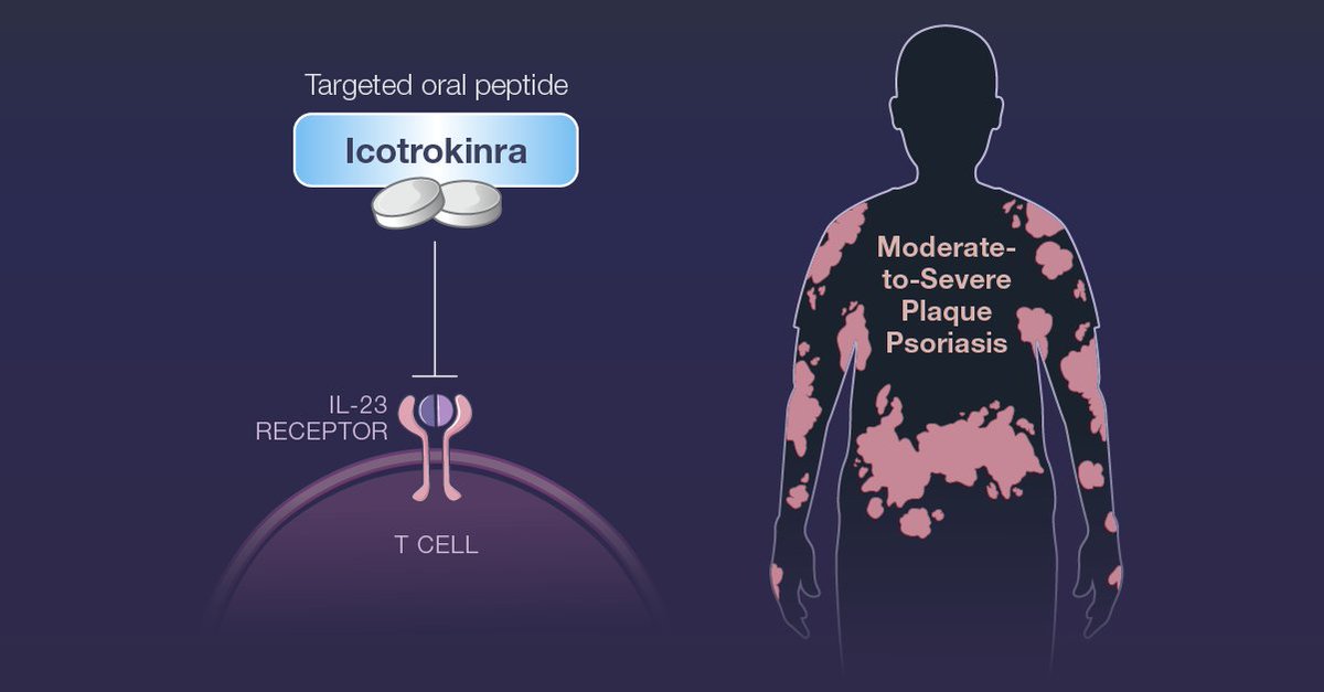 For moderate-to-severe plaque psoriasis, biologic therapies are highly effective but are available only by injection, and current oral therapies are often less effective. Research findings from the ICONIC-LEAD phase 3 trial are summarized in a Quick Take video.