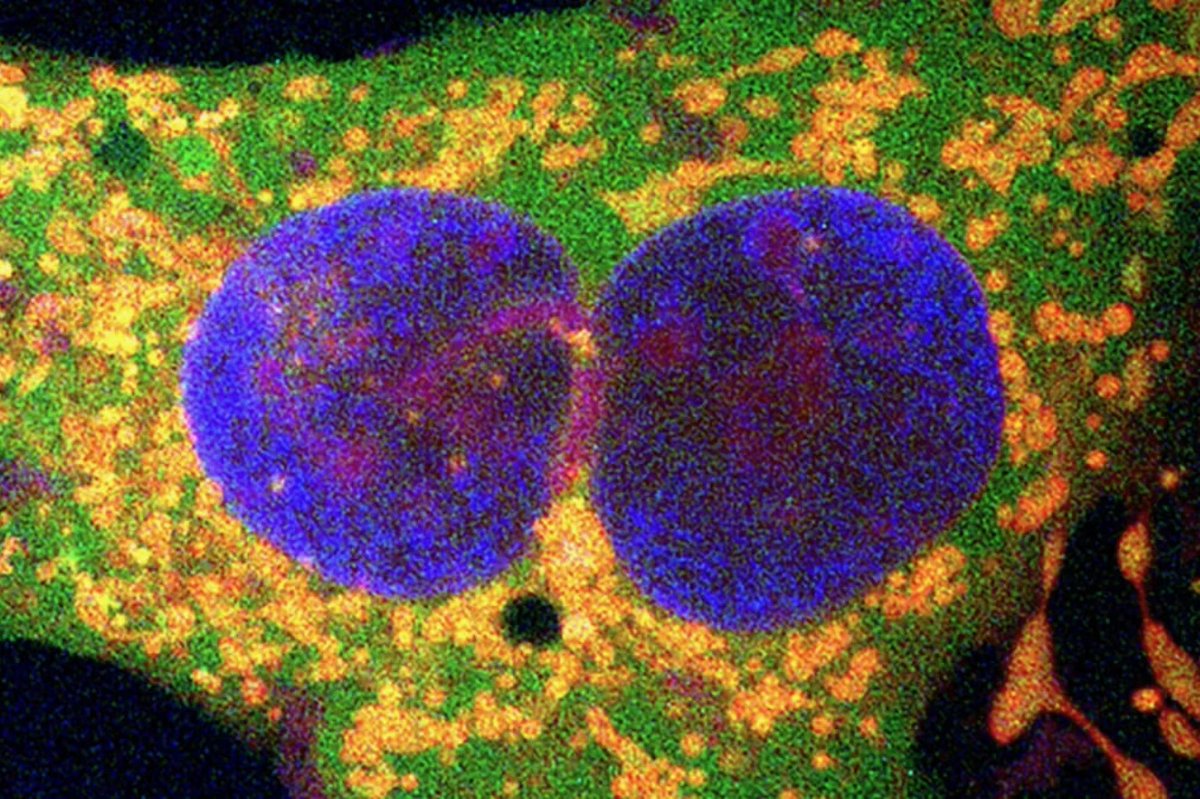 nwtls's tweet image. Who are the real mutants, and what’s going to cure them?

newatlas.com/medical-tech/b…

#BacterialRetrons #GeneEditing #MutationCure #CellularContractors