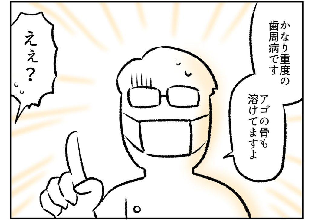 歯がなくなりかけた話(3/3)

※続きはこちらから全部無料でよめます🙇‍♂️
↓
https://t.co/GXXM922zXd 