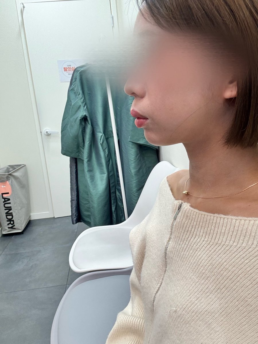 HRK126's tweet photo. シンサ駅すぐ近くのロリポップ美容整形外科で顎フィラーしてきた✌🏻
前回よかったから、今回は長持ちするジュビダーム2cc入れてもらったけど、めっちゃ変わってフェイスライン綺麗になって嬉しい☺️
スタッフさんみんな優しくて、おすすめです🍬
@lollipopclinic https://t.co/SoSq97wJIy