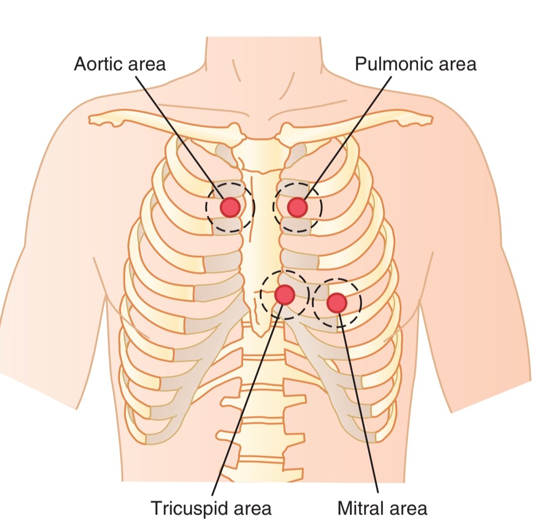 TrackYourHeart's tweet photo. Chest areas from which sound from each valve is best heard. https://t.co/7I8yeAedCf