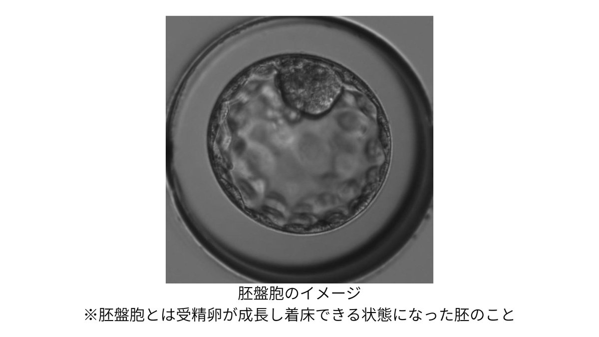 cbc_metone's tweet photo. 40歳で卵子凍結！
42歳で妊娠・出産を叶えた体験談！

名古屋市にお住いのA子さん。
ご自身の体験談を誰かの役に立てればという気持ちでセミナーに登壇。
良いことばかりではなく「全員にお勧めすることはできない」とリアルな気持ちを話してくれました。

卵子凍結セミナーの取材記事④はコチラ👇
https://t.co/n9w3ineohU