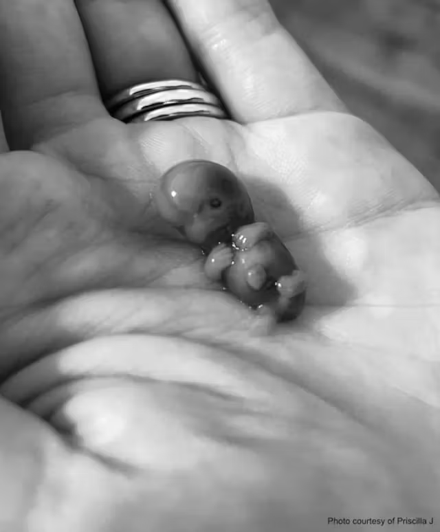 iarsuaga's tweet photo. Priscilla perdió a su bebé a las 9 semanas.

Ahora comparte sus fotos para mostrar a la gente que “cada niño es una vida humana que no podemos eliminar”. https://t.co/8kiopbXgts