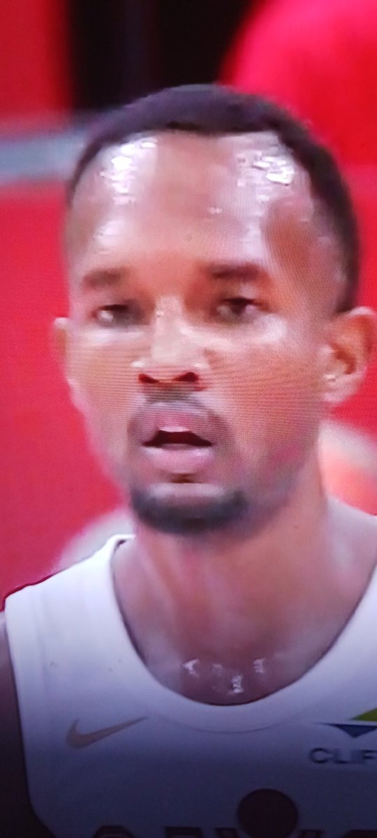Blackhippy1221's tweet photo. @cavs  Evan Mobley is one if my favorite cabs players ever. But this hair cut is unacceptable. #LetEmKnow #Cavs https://t.co/SfEo6w4Y65
