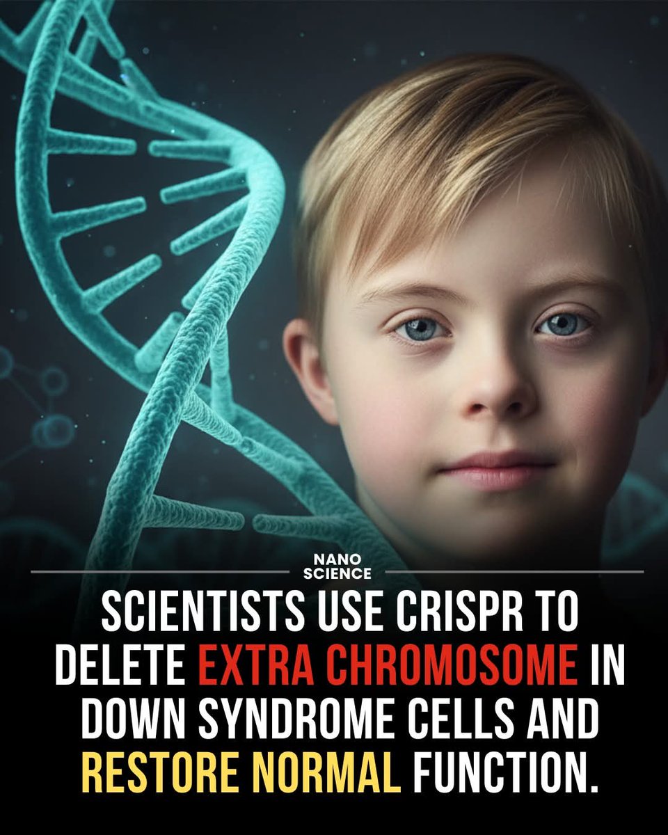 STARFORCEHH's tweet image. 🧬🔬 In a groundbreaking study, researchers in Japan have shown it’s possible to use CRISPR to actually cut out the extra chromosome that causes Down syndrome, potentially reversing many of its cellular effects. Down syndrome happens when someone has three copies of chromosome 21…