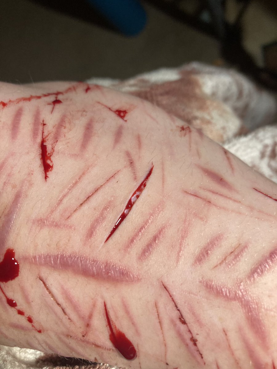 onewayroadcult's tweet photo. 😵‍💫 (if it looks weird my arm is squished on my knee in the image lol) https://t.co/juCDjy7zNF