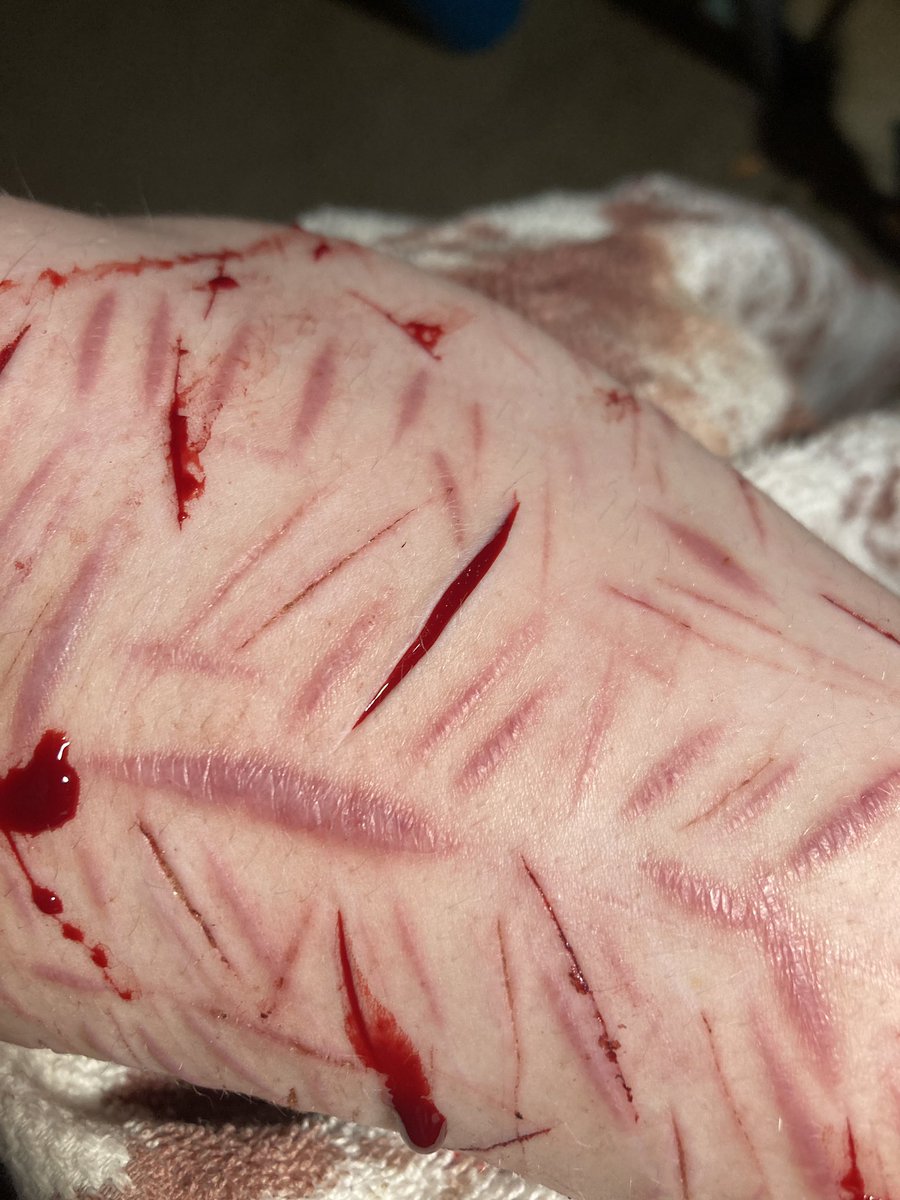 onewayroadcult's tweet photo. 😵‍💫 (if it looks weird my arm is squished on my knee in the image lol) https://t.co/juCDjy7zNF
