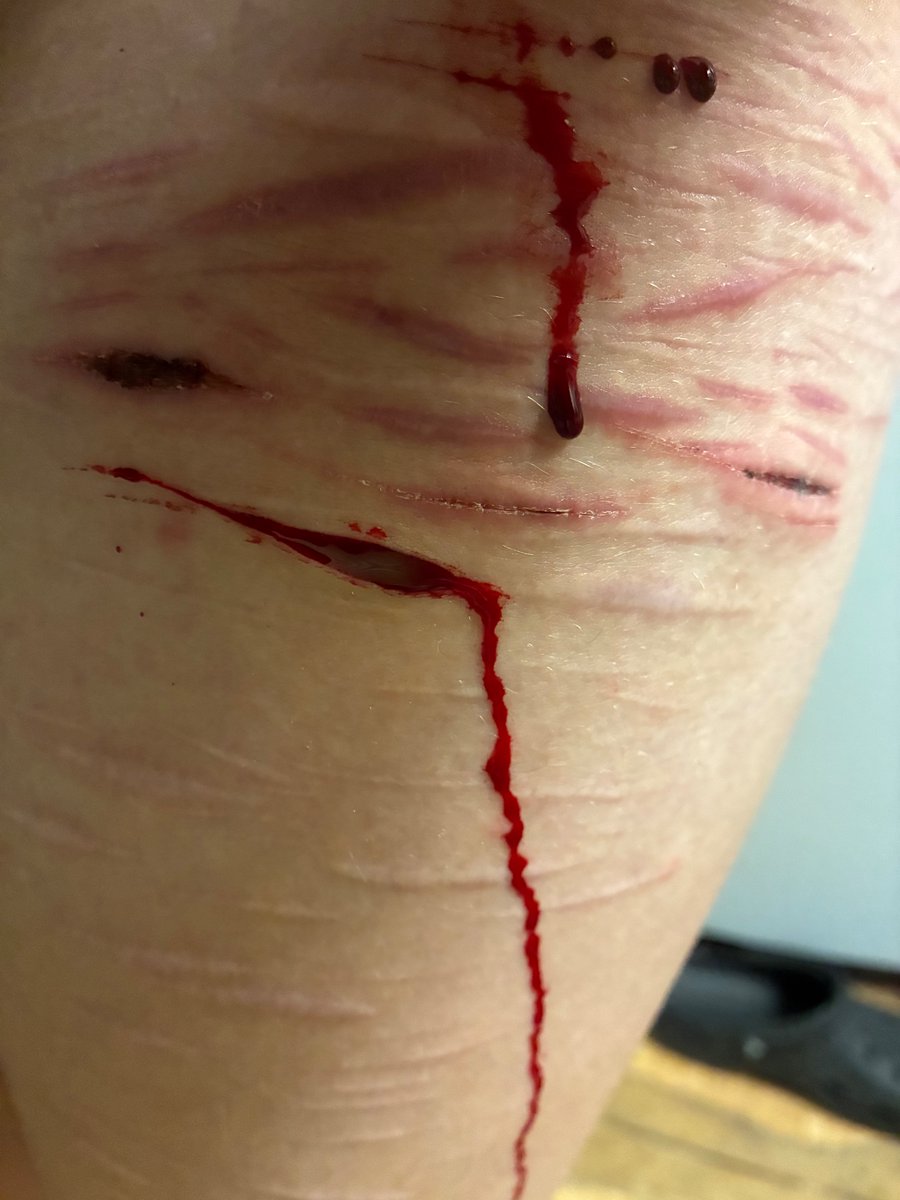 ♥︎ᴅᴀɪꜱʏ ᴏꜰ ꜱʜᴛᴡᴛ♥︎ tweet media